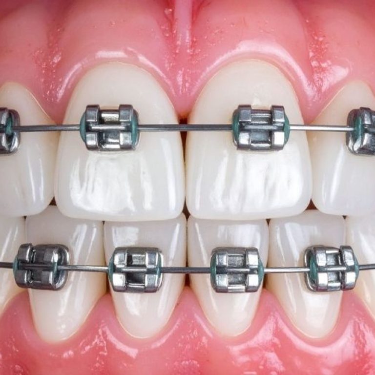 Bir başlık ekleyin (7)