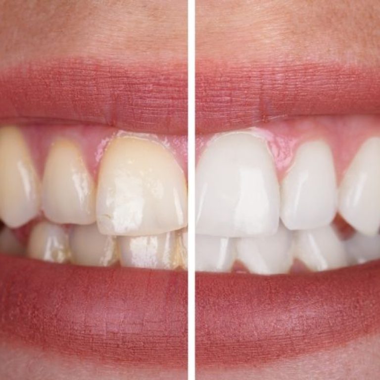 Bir başlık ekleyin (9)