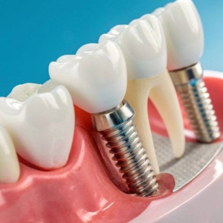 Bir başlık ekleyin